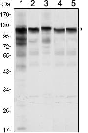 HK1 / Hexokinase 1 Antibody (clone 7A7)