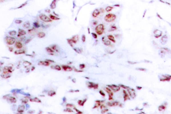 MEF2A / MEF2 Antibody (Ala306)