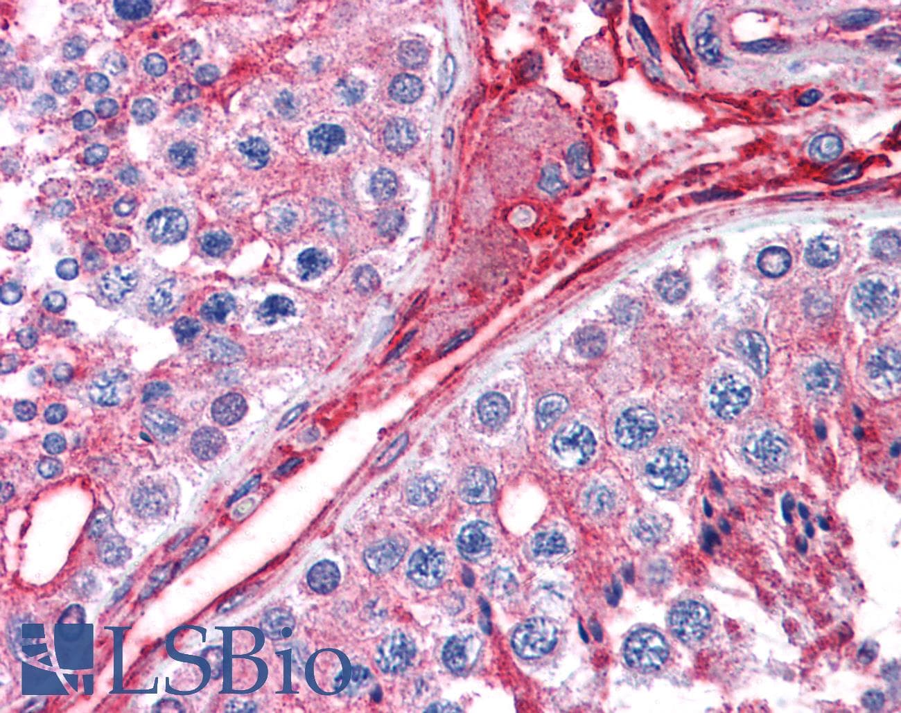 IHC-plus™ Polyclonal Goat anti-Human DCYTB / CYBRD1 Antibody (aa273-286, IHC)