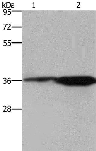 FCAR / CD89 Antibody