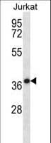 HSPBP1 Antibody (aa69-97)