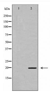 MRLC2 / MYL12B Antibody (phospho-Ser18)