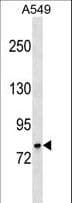 GLB1 / Beta-Galactosidase Antibody (aa81-109)