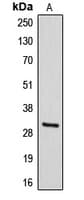 Polyclonal Rabbit anti-Human DIO3 Antibody (Internal, WB)