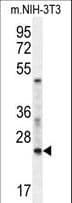 Polyclonal Rabbit anti-Human RAN Antibody (aa112-140, IHC, WB)
