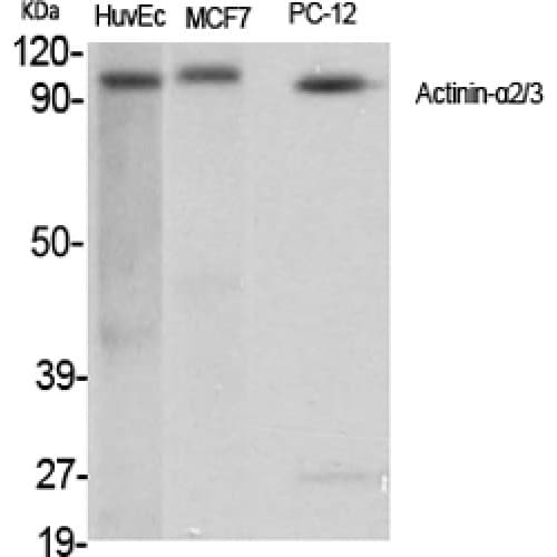 Actinin-Alpha 2+3 Antibody (1-80 aa, N-terminal)