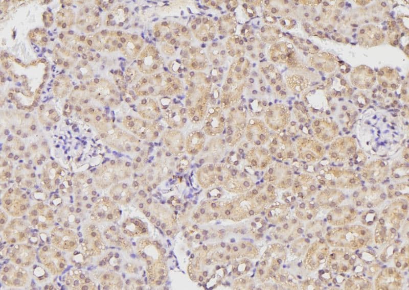 ETK / BMX Antibody