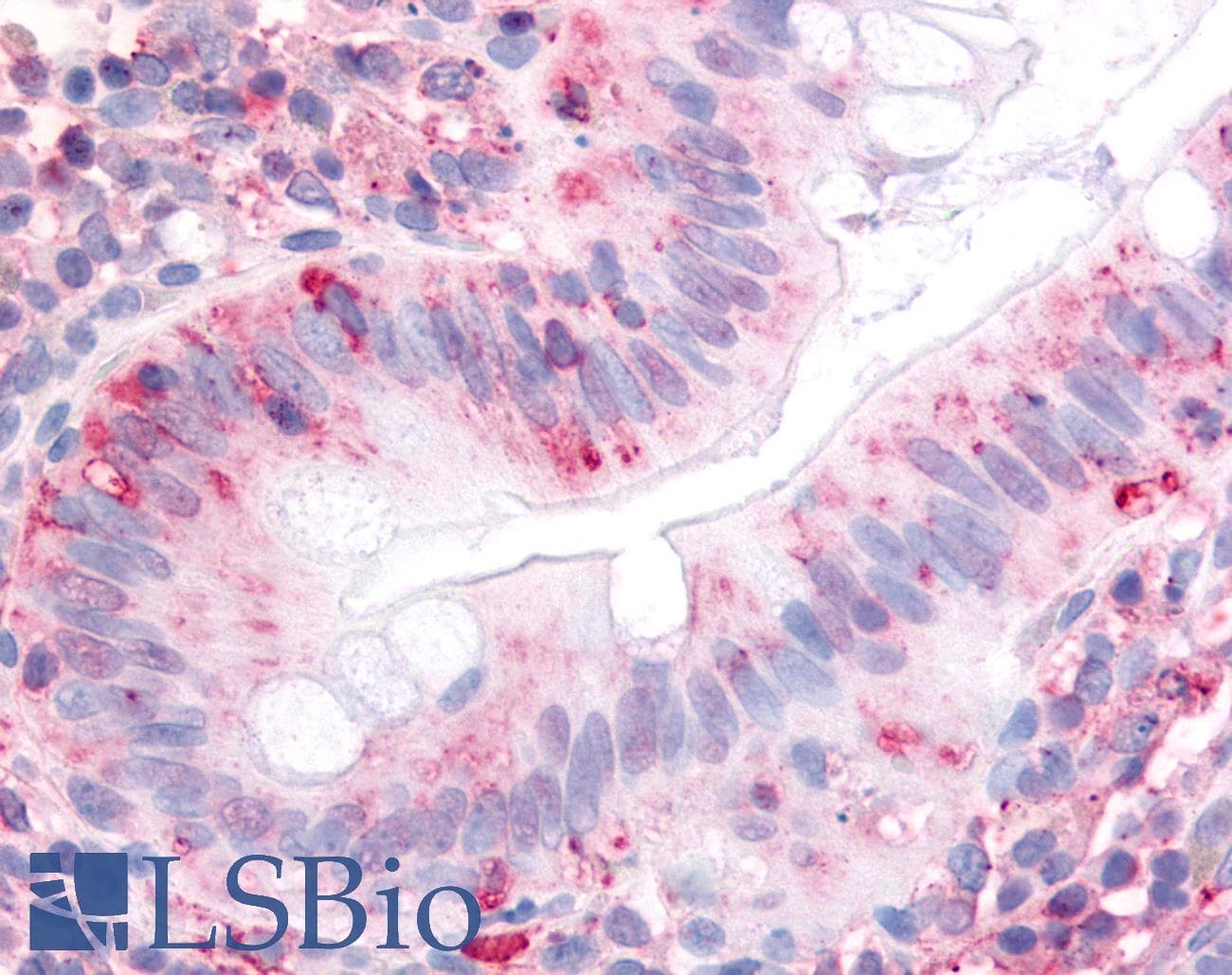 IHC-plus™ ITGA2 / CD49b Antibody (Extracellular Domain)