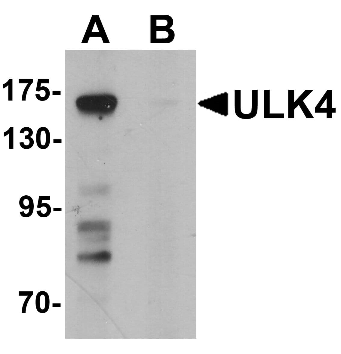 IHC-plus™ ULK4 Antibody