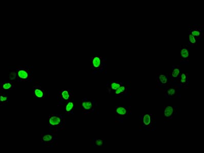 HIST1H1B Antibody