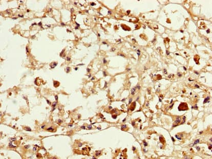 MAGEA3 Antibody