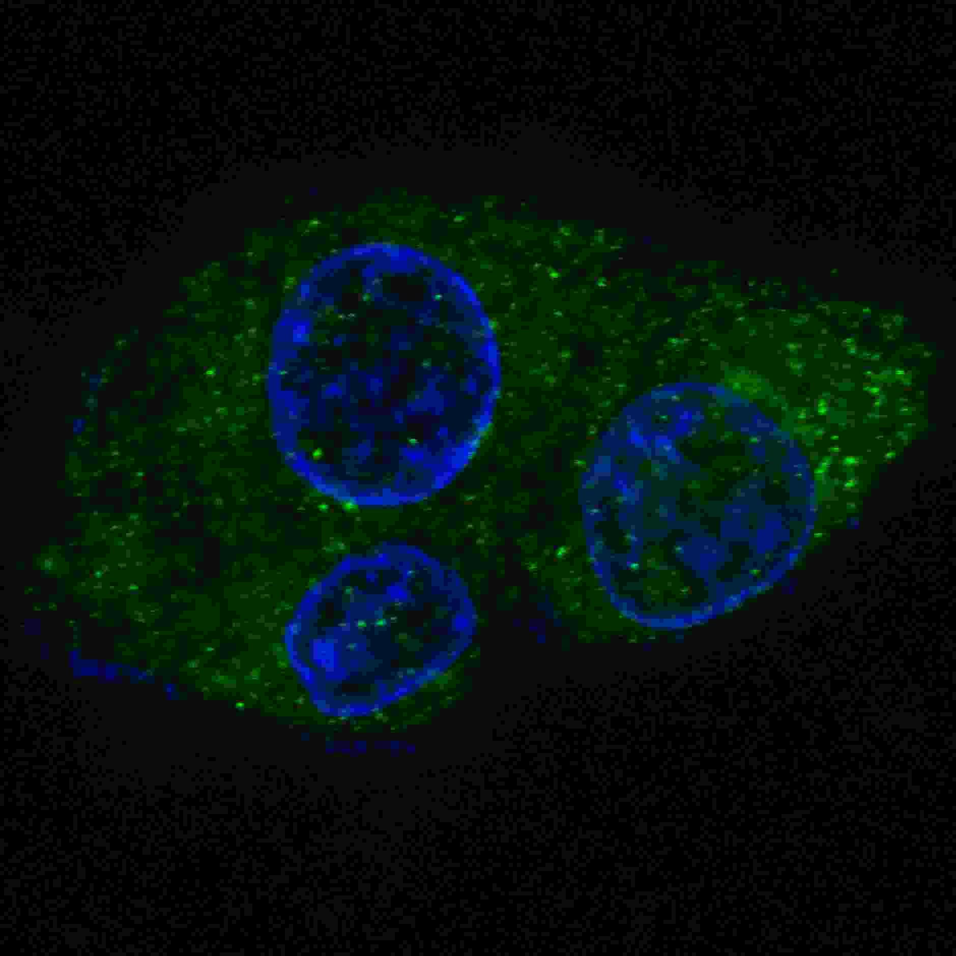 IHC-plus™ Polyclonal Rabbit anti-Human FASN / Fatty Acid Synthase Antibody (aa942-973, IHC, IF, WB)