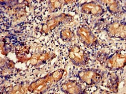 Polyclonal Rabbit anti-Human UAP1 Antibody (IHC, IF, WB)
