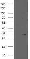 Monoclonal Mouse anti-Human 15-PGDH / HPGD Antibody (clone OTI1E9, IHC, WB)