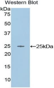 TNIP2 / ABIN-2 Antibody (aa20-200, Cy3)