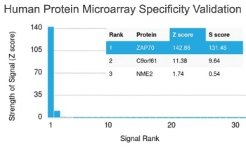 Monoclonal Mouse anti-Human ZAP70 Antibody (clone ZAP70/2046, IHC)