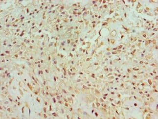 Polyclonal Rabbit anti-Human BANP Antibody (aa1-260, IHC, WB)