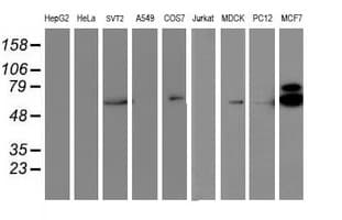 RPS6KB1 / P70S6K / S6K Antibody (clone OTI6B2)
