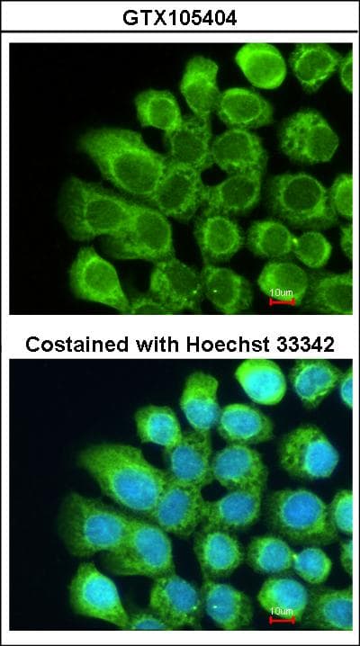 Complement C2 Antibody (aa265-642)