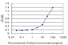 IHC-plus™ Monoclonal Mouse anti-Human BAF60B / SMARCD2 Antibody (clone 2F7, IHC, IF, WB)