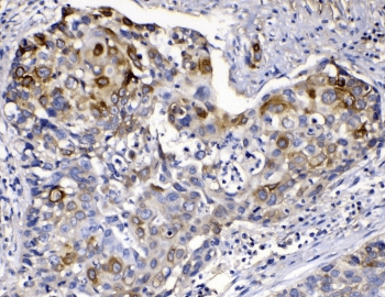 KRT14 / CK14 / Cytokeratin 14 Antibody
