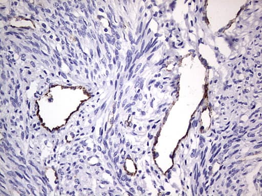 VWF / Von Willebrand Factor Antibody (aa764-1263, clone OTI6C7)