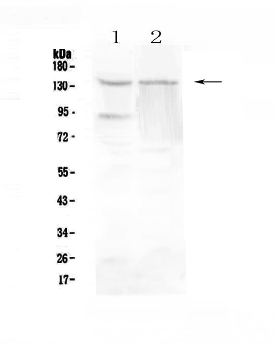 Polyclonal Rabbit anti-Human RTEL1 Antibody (WB)