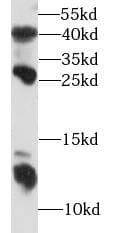 S100A8 / MRP8 Antibody
