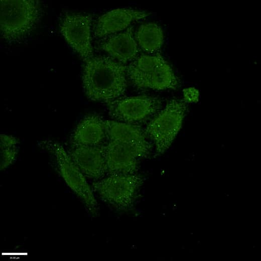 SSX1 Antibody