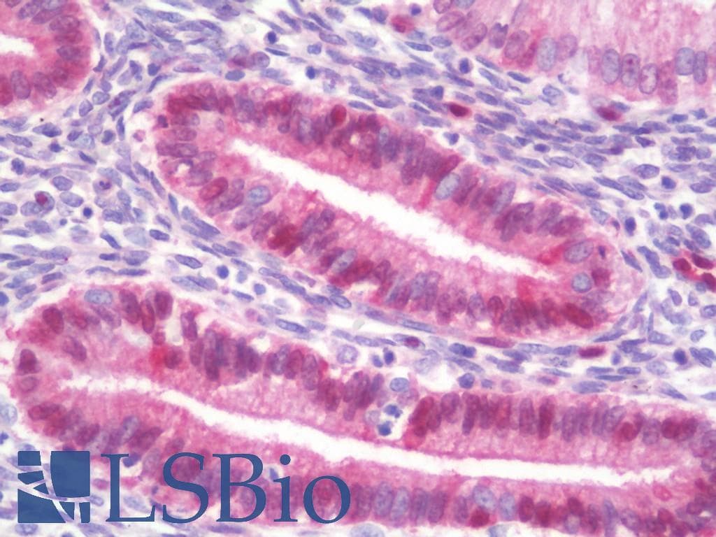 IHC-plus™ HSPH1 / HSP105 Antibody (aa717-745)