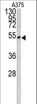 IHC-plus™ Polyclonal Rabbit anti-Human Lumican Antibody (aa198-227, IHC, WB)