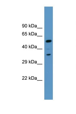 MARCKS Antibody (aa256-305)