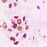 Polyclonal Rabbit anti-Human PIAS3 Antibody (N-Terminus, IHC, WB)