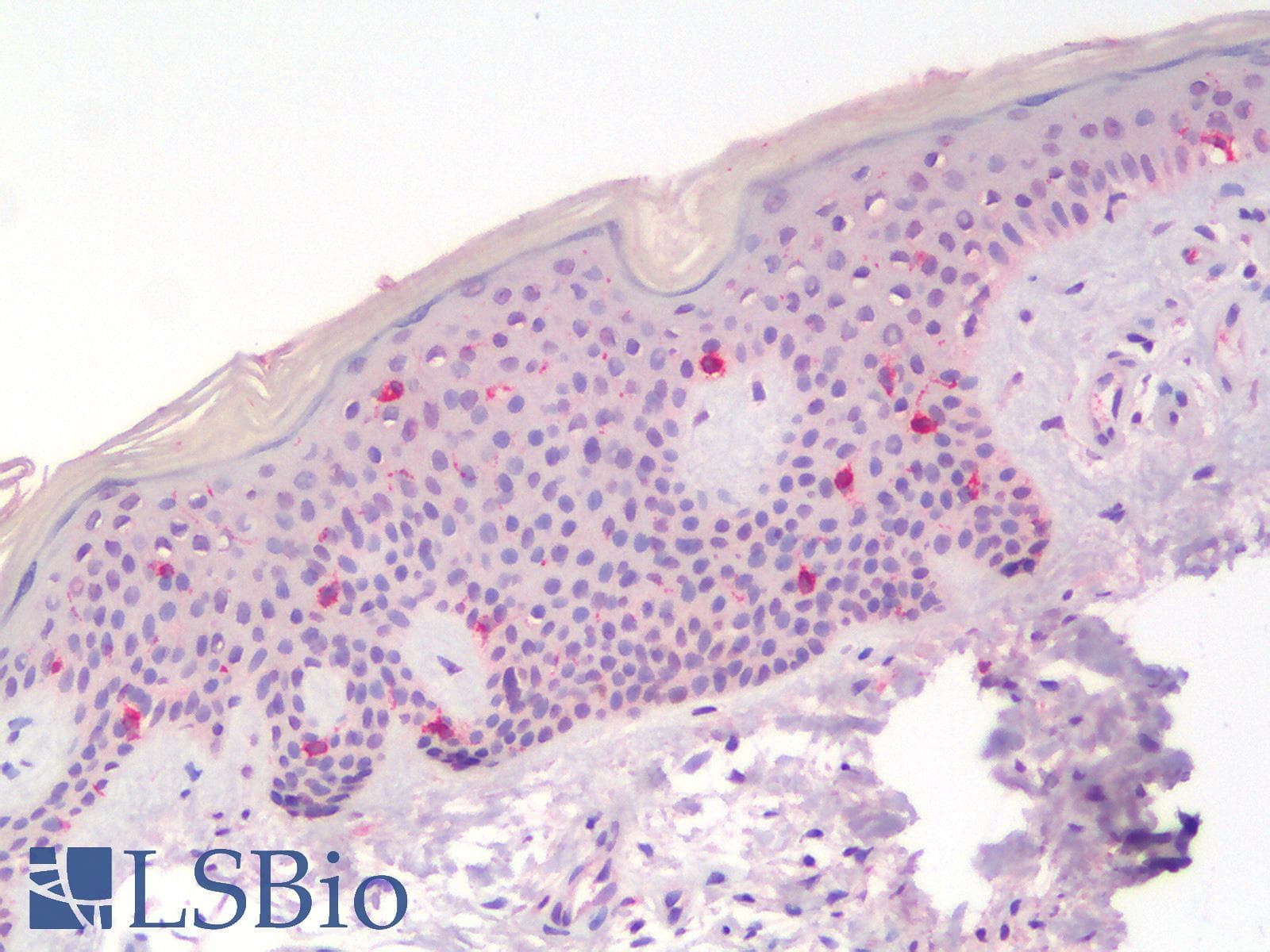 PathPlus™ Polyclonal Rabbit anti-Human CD207 / Langerin Antibody (IHC)