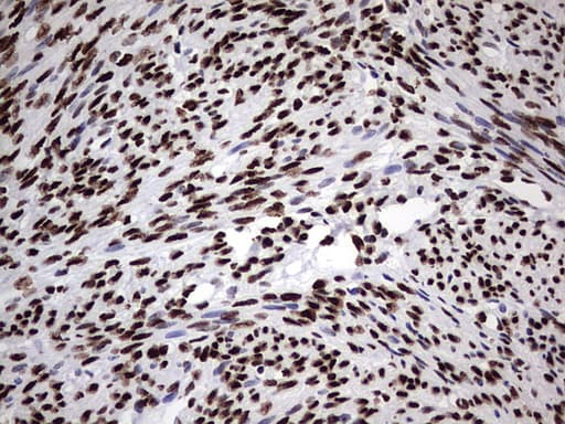 HNRPM / HNRNPM Antibody (aa1-261, clone OTI4C9)