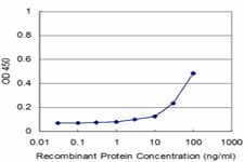 MECOM / EVI1 Antibody (clone 1E7)