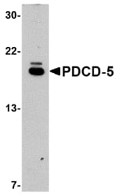 IHC-plus™ PDCD5 Antibody