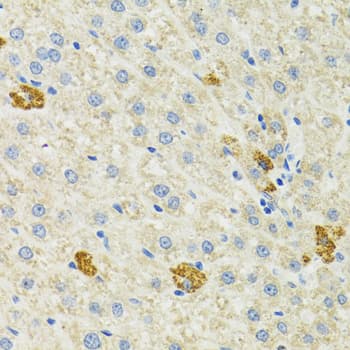 Polyclonal Rabbit anti-Human HSPA9 / Mortalin / GRP75 Antibody (IHC, IF, WB)