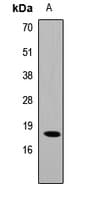 CIRP / CIRBP Antibody