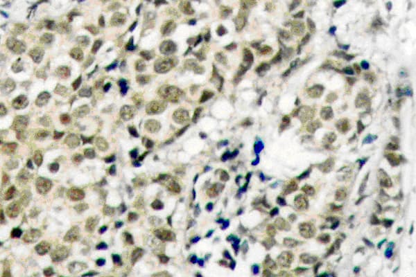 AR / Androgen Receptor Antibody (Gly207)
