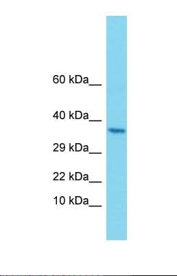 ALG1 Antibody (C-Terminus)
