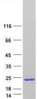 Human SNCA / Alpha-Synuclein Protein (Recombinant Myc-DDK (Flag))