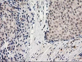 ADH2 / ADH1B Antibody (clone OTI4F12)