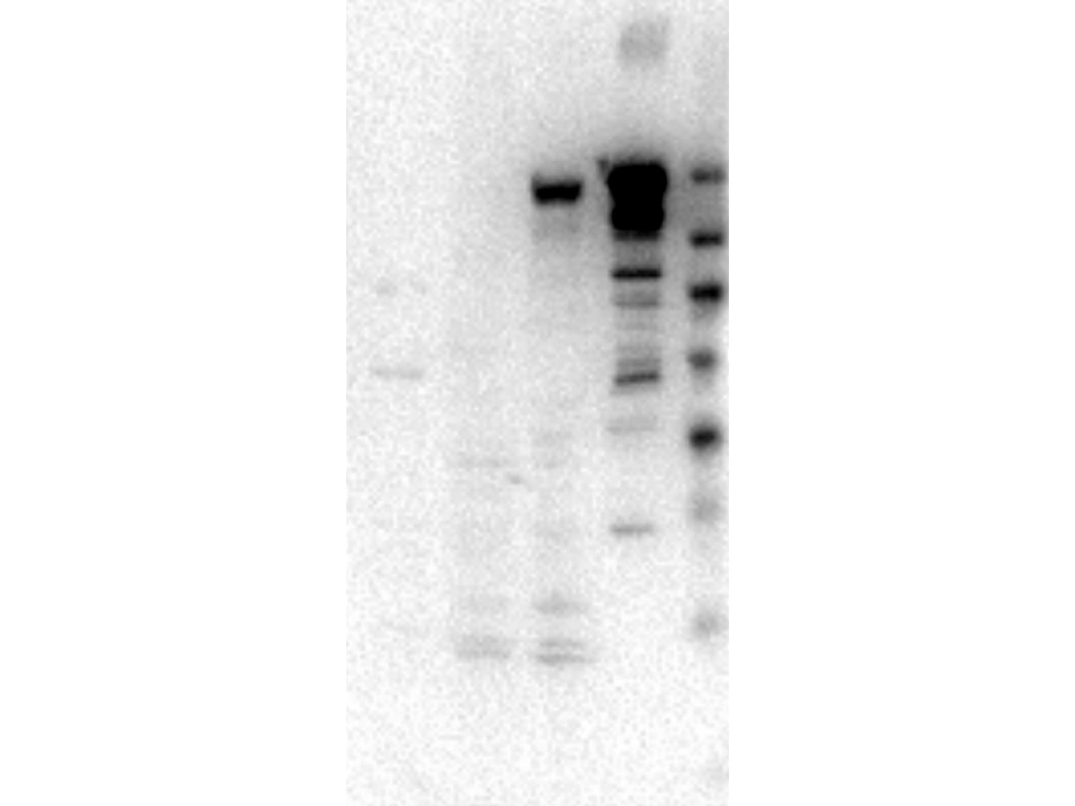 Polyclonal Rabbit anti-Human Myosin VI / MYO6 Antibody (WB)