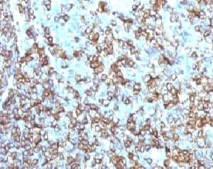 HLA-DRB1 Antibody (clone MHDRb2)