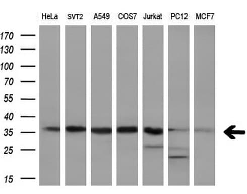 Monoclonal Mouse anti-Human PPP1CA / PP1-Alpha Antibody (clone OTI6E5, Carrier-free, IHC, WB)