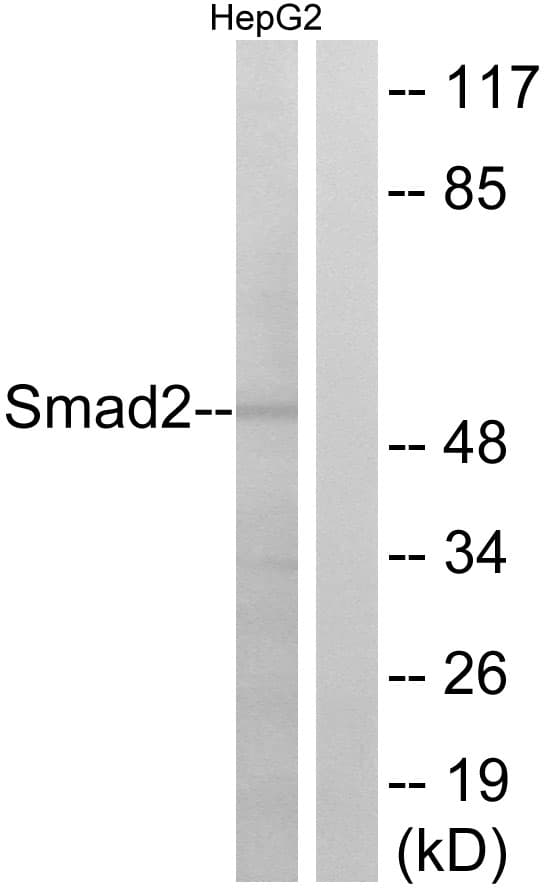 Polyclonal Rabbit anti-Human SMAD2 Antibody (aa221-270, WB)