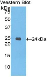 SPON1 / F-Spondin Antibody (aa608-802)