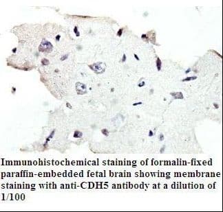 CD144 / CDH5 / VE Cadherin Antibody (aa769-784)