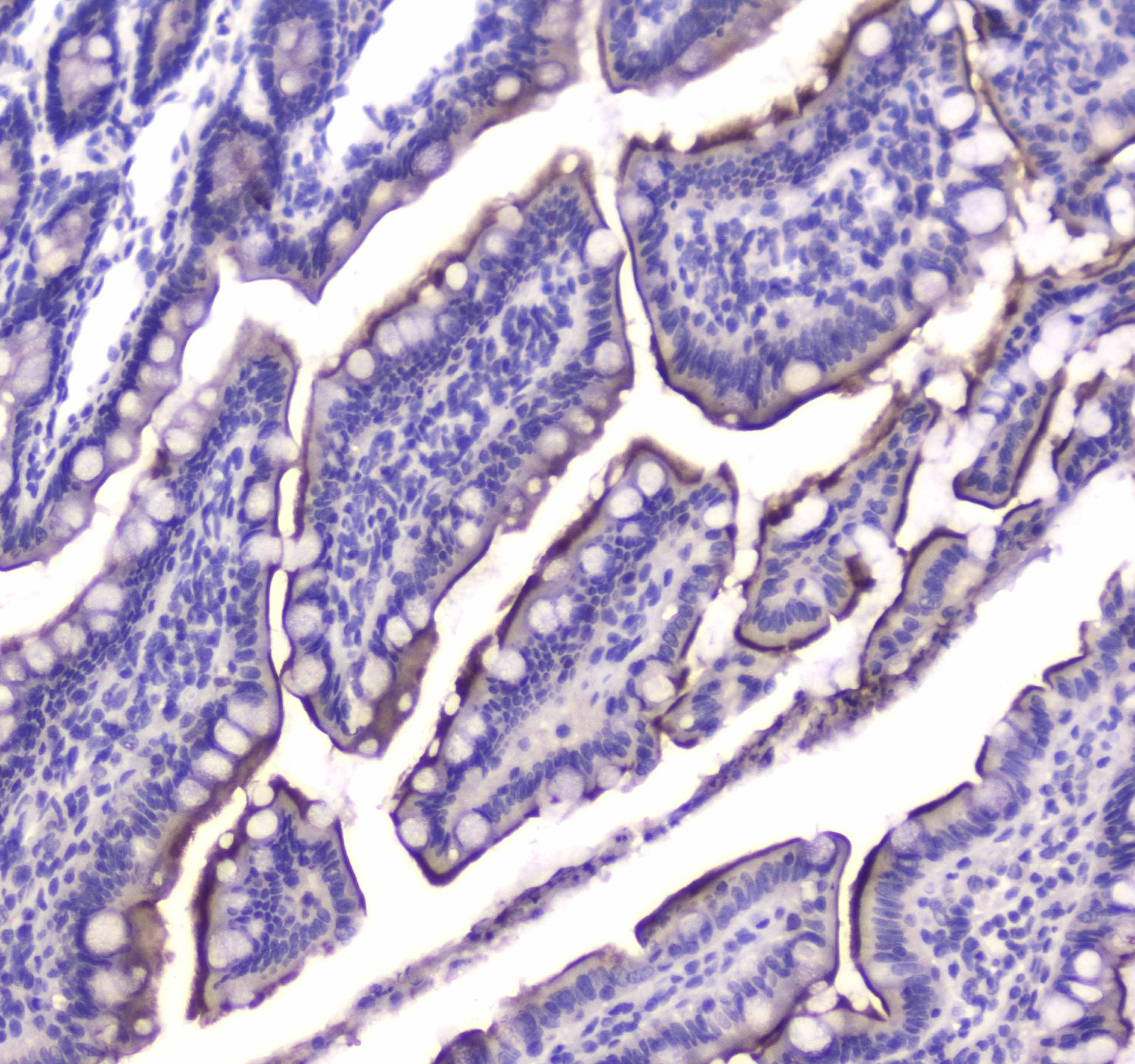 Polyclonal Rabbit anti-Human CNR1 / CB1 Antibody (IHC, WB)